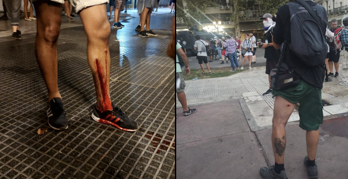 Represión y ataque a la libertad de expresión: más de 25 trabajadores de prensa heridos