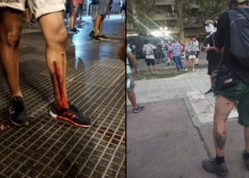 Represión y ataque a la libertad de expresión: más de 30 trabajadores de prensa heridos